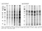 Silicon induces polyubiquitin and peroxidase and increases protein content and phenols in proso millet