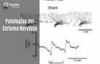 Patologías del Sistema Nervioso