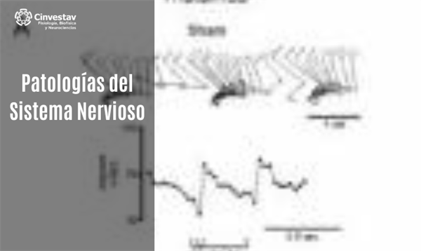 Patologías del Sistema Nervioso