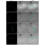 Endobacteria Have a Negative Effect on the Virulence of Metarhizium